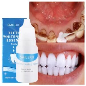 Suero Blanqueador Dental Anti Manchas Dientes Blancos